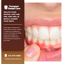 Torrance Dental Care 4