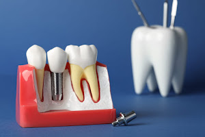 Arbor Dental - San Jose 4