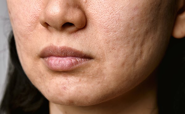 DermaBlue photo 1