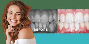 Beverly Hills Orthodontics Century City 9