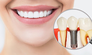 Seascape Cosmetic and Implant Dentistry - Huntington Beach 4