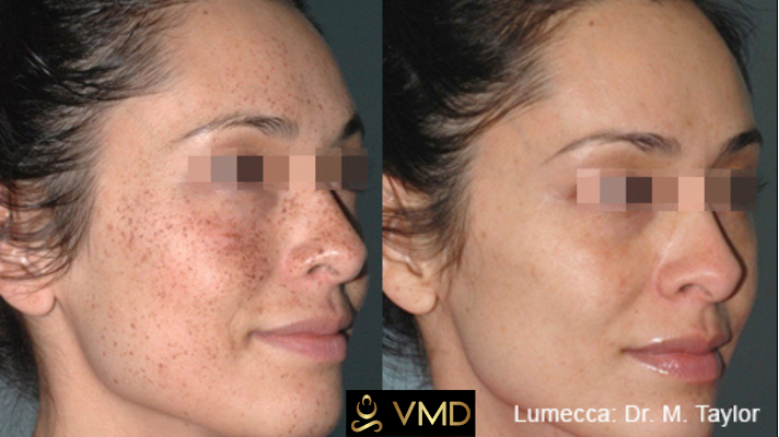Clean, professional medical spa treatment room with neutral tones at Vivanamd in Destin
