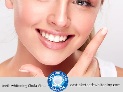teeth whitening Chula Vista, CA