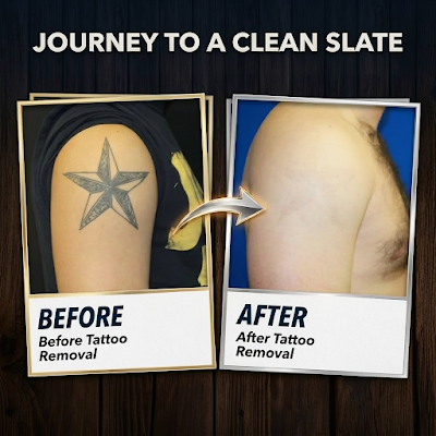 Clean, professional medical spa treatment room with neutral tones at Jain Plastic Surgery Pc in Columbus