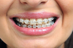 Massih Orthodontics 4