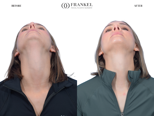 Clean, professional medical spa treatment room with neutral tones at Frankel Facial Plastic Surgery Llc in Mayfield Heights