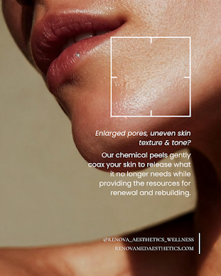 Clean, professional medical spa treatment room with neutral tones at Renova Medical Aesthetics in Westchester