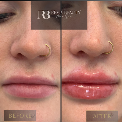 Clean, professional medical spa treatment room with neutral tones at Reviv Beauty in Sanford