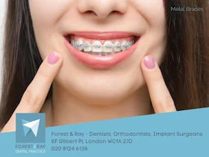 Tooth Fillings in Central London  Forest & Ray - Dentists, Orthodontists,  Implant Surgeons