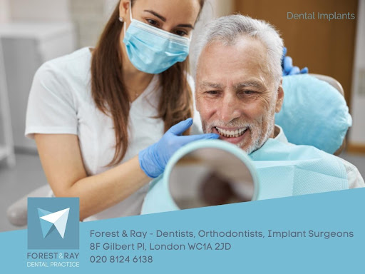 Tooth Implant London