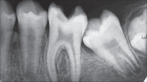 Dental X-ray