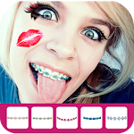 Cover Image of Download Braces Booth Photo 1.0 APK
