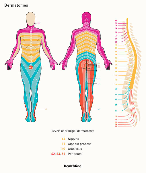 Lumbar-L4-L5-disc-herniation