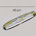 Epilithic Diatom