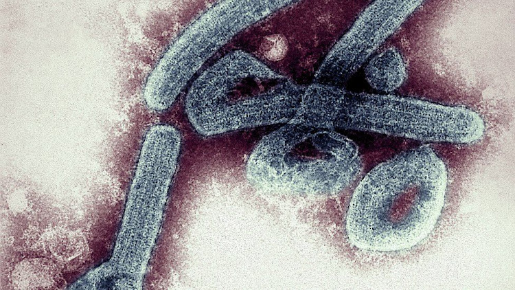 The Marburg virus was first detected in the city of Marburg in Germany in 1967