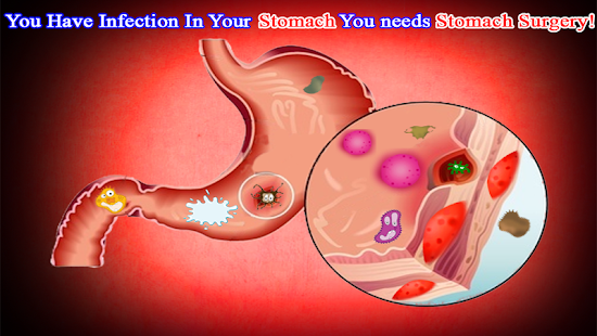   Surgery Simulator Doctor Game- screenshot thumbnail   