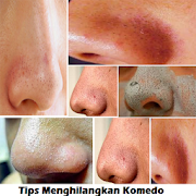 Tips to Remove Blackheads  Icon