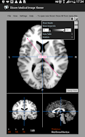 Dicom Medical Image Viewer Screenshot