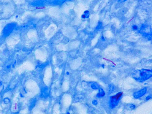 Mycobacterium tuberculosis Ziehl-Neelsen stain. The bacteria has been stained red to show up against the blue tissue.