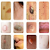 All Common Skin Disorders & Treatments A-Z icon