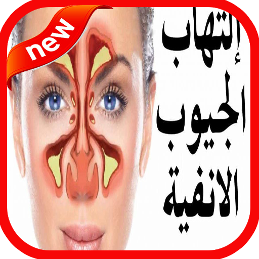 علاج إلتهاب الجيوب الأنفية‎