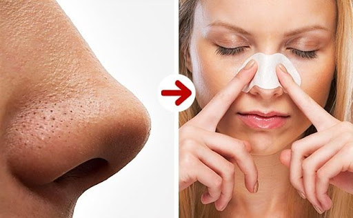 Đám mụn đầu đen sẽ biến mất sau một nốt nhạc với chiếc mặt nạ này. (Ảnh internet)