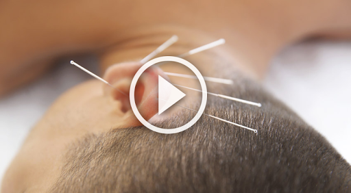 Acupuncture point location