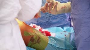 Image result for orthopedic surgeon in colorful