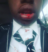 A group of learners has been suspended after an alleged bullying incident at Selborne College in East London.