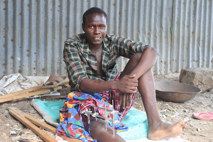 19-year old Tugen NPR Pius Chepkuto nursing a knee bullet injury outside dilapidated house at Sandai, Baringo South on April 1.