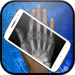 Cover Image of Download Xray Scan Prank 1.0 APK
