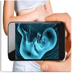 Ultrasound Scanner (Prank) Apk