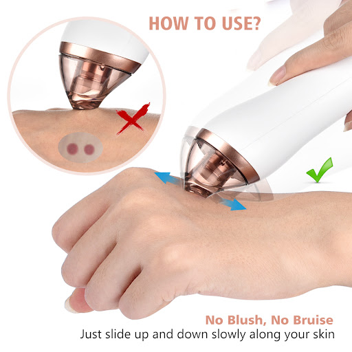 Title 7, Electric Blackhead Facial Cleansing and Beauty ...