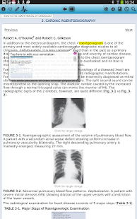 Free Hurst's the Heart Manual, Card APK for Android