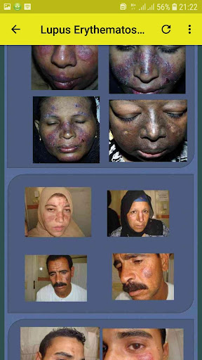 Color Atlas of Skin Diseases - Dermatology Atlas