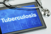 A new study has found that South Africans diagnosed with TB are more likely to be depressed. 