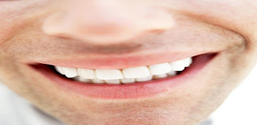 Download Teeth Whitening for PC