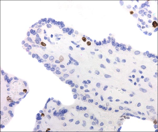 Immature villus stained with Ki-67, a cellular proliferation marker. Note that the brown-stained nuclei are beneath the syncytium. This is the cytotrophoblast, the Langhans' cells