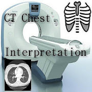 CT Chest Interpretation  Icon