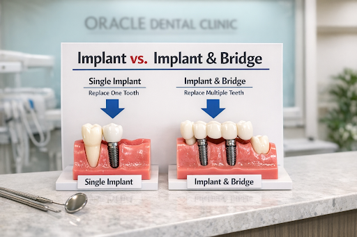 Oracle Dental Clinic - Chipiyana Buzurg | Ghaziabad — business photo 10