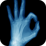 Best X-Ray FREE Apk