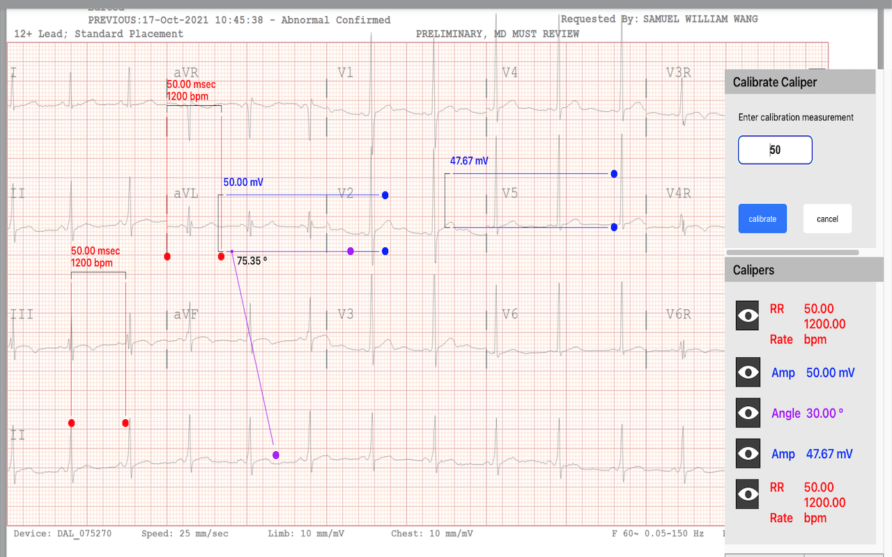 Caliper App Preview image 3