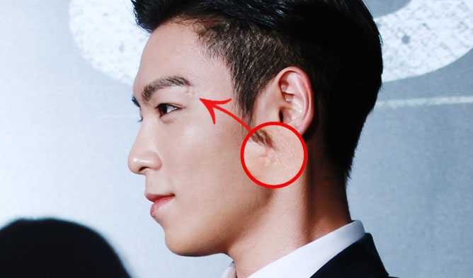 11 K Pop Idols With Endearing Scars And Birthmarks Korea Trend News