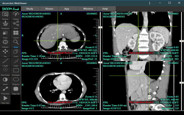 dicom.link DicomViewer chrome extension