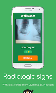 Radiologic signs(圖2)-速報App