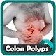 Download Colon Polyps For PC Windows and Mac 1.0