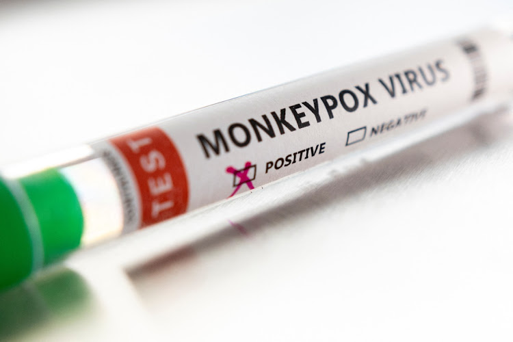 SA experts say at this point they don't see the need for a monkeypox vaccination campaign in the country. File image.