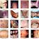 Atlas of All Skin Infections, Diseases &Treatments icon