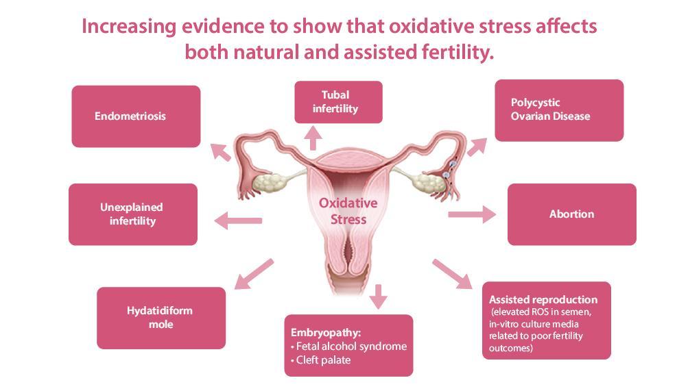 Oxidative Stress affects both natural and assisted fertility