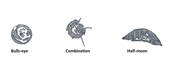 The various types of chips that can be identified by PG Glass Fitment Centre technicians.